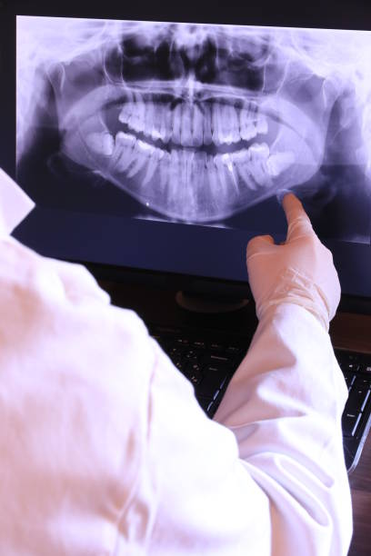 Best Emergency Dental Extractions in Poplar Grove, IL